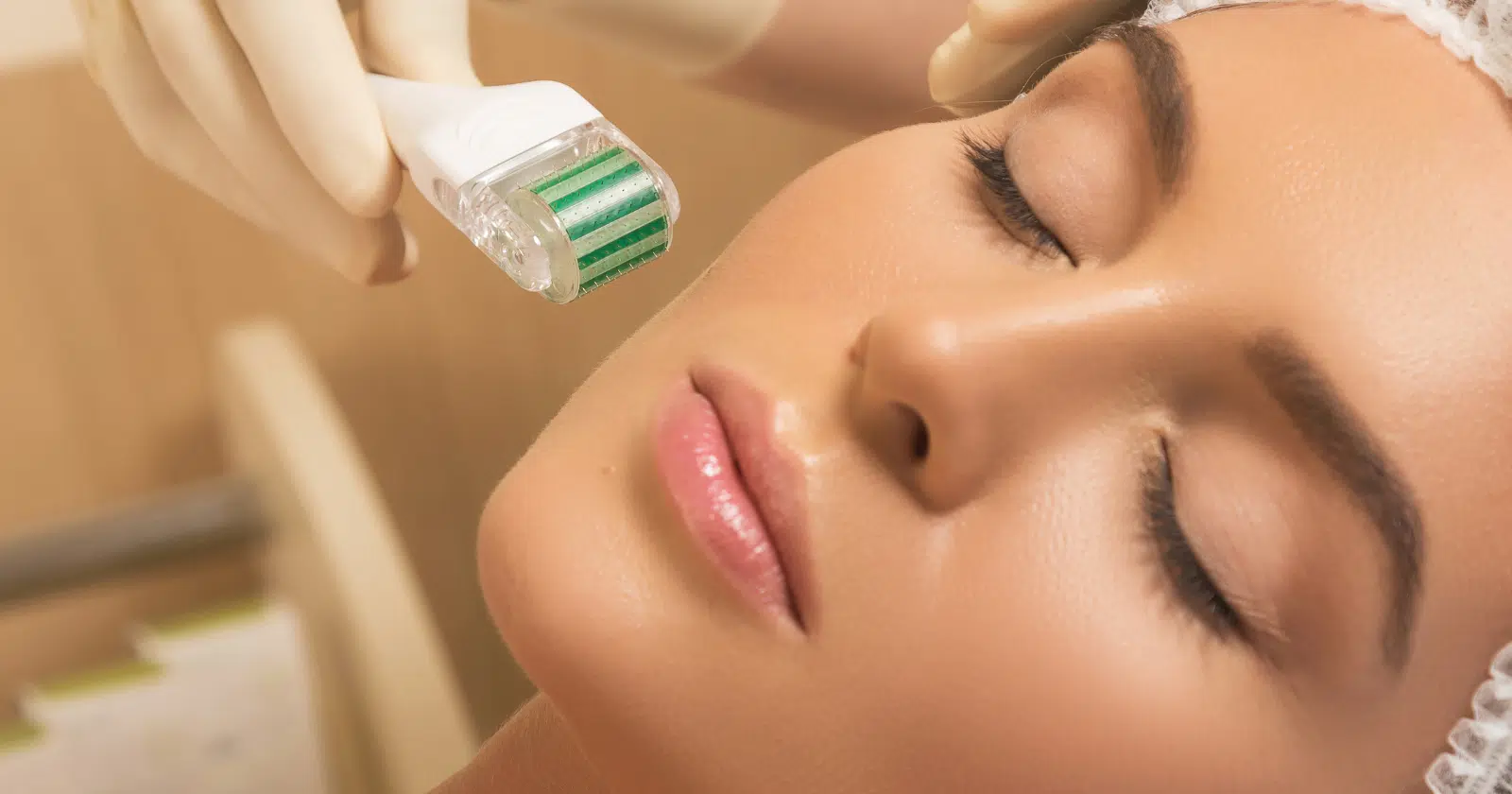 closeup of woman's face and a hand holding a microneedling roller